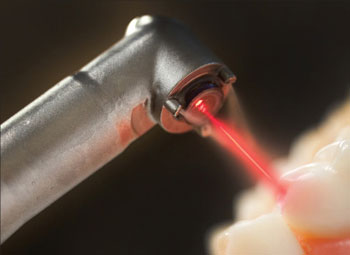 Lasers are helpful in dentistry as well because they can aid in better tissue response, stop cold sore growth, minimize canker sores, trim tissue and stop bleeding, according to area dental professionals.